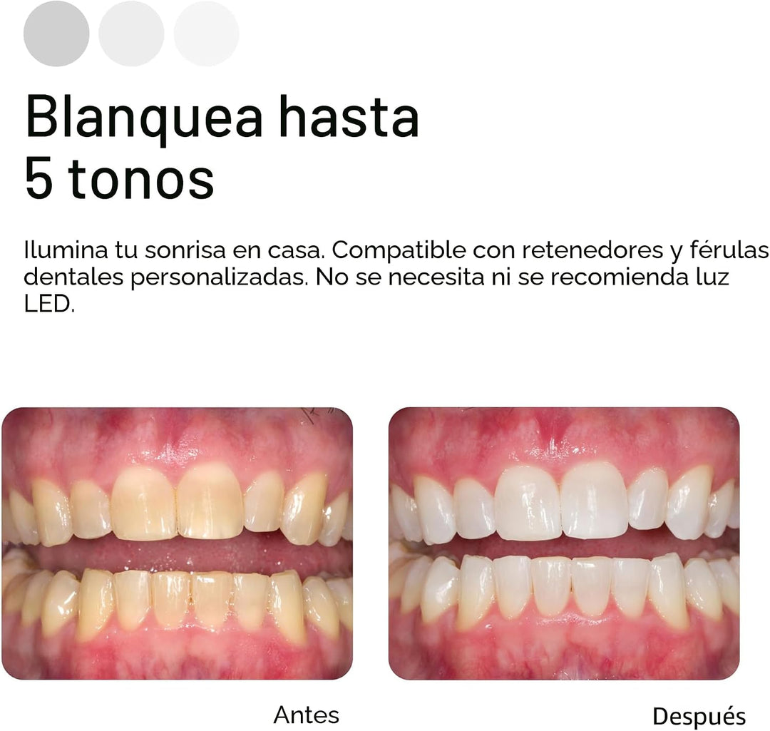 Opalescence Kit de recambio de blanqueamiento dental al 20% (4 jeri...