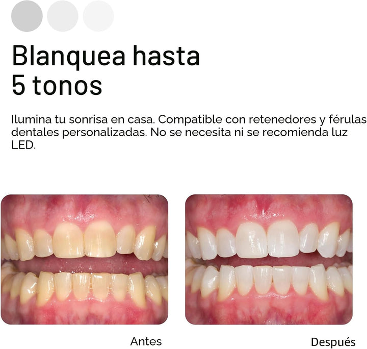 Opalescence Kit de recambio de blanqueamiento dental al 20% (4 jeri...