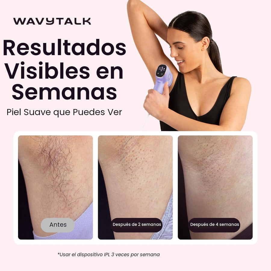 Wavytalk - Dispositivo de depilación láser IPL, desnuda con rodillo...