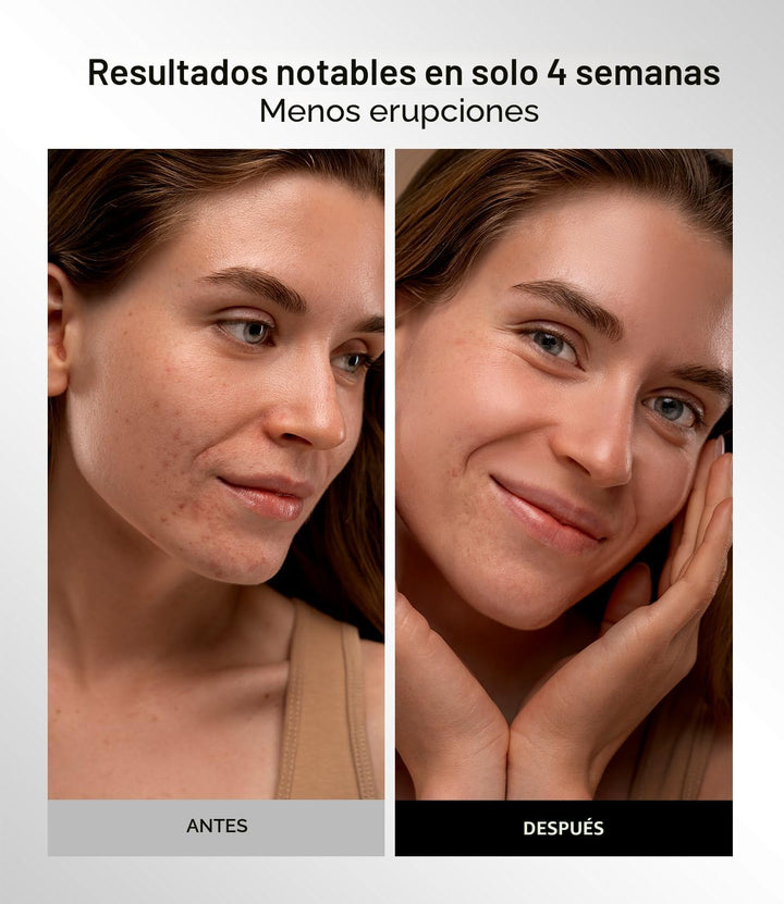 Máscara de terapia de luz roja para cara y cuello, 4 modos de luz c...