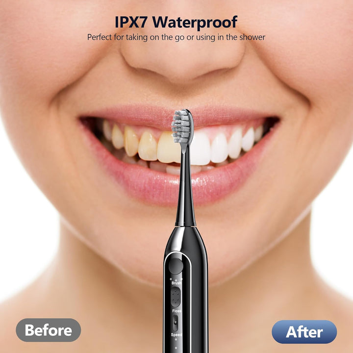 Benhip Cepillo de dientes eléctrico con hilo dental de agua combina...