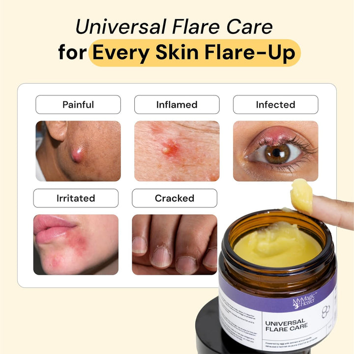 MyMagicHealer Cuidado Universal para Inflamaciones | Ungüento de At...