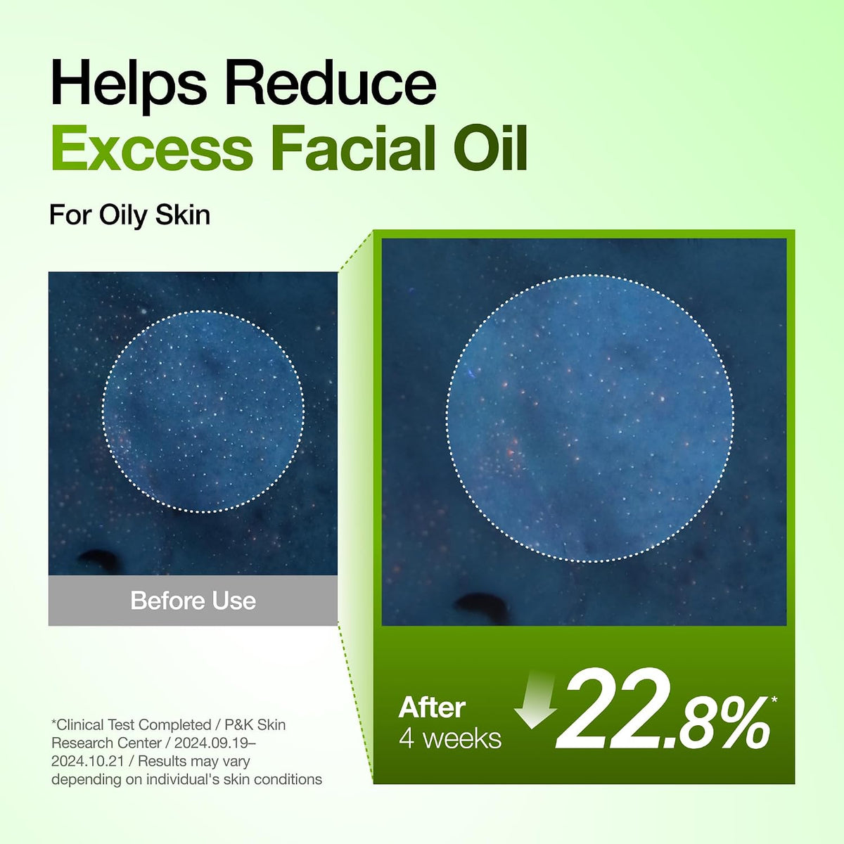 Anua Suero Facial de Ácido Azelaico 10% Hialurónico en Rojo Tranqui...
