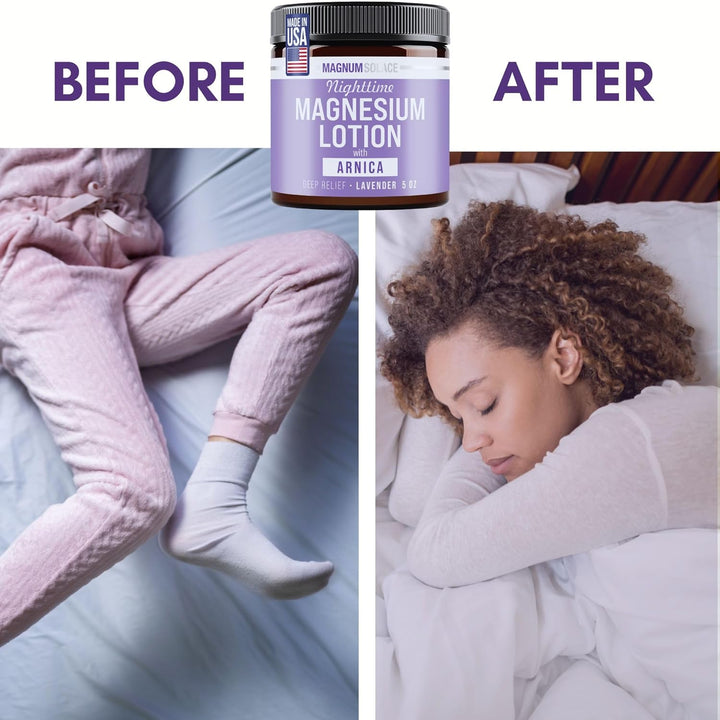 Magnum Solace Nighttime Magnesium Lotion Arnica Soothing