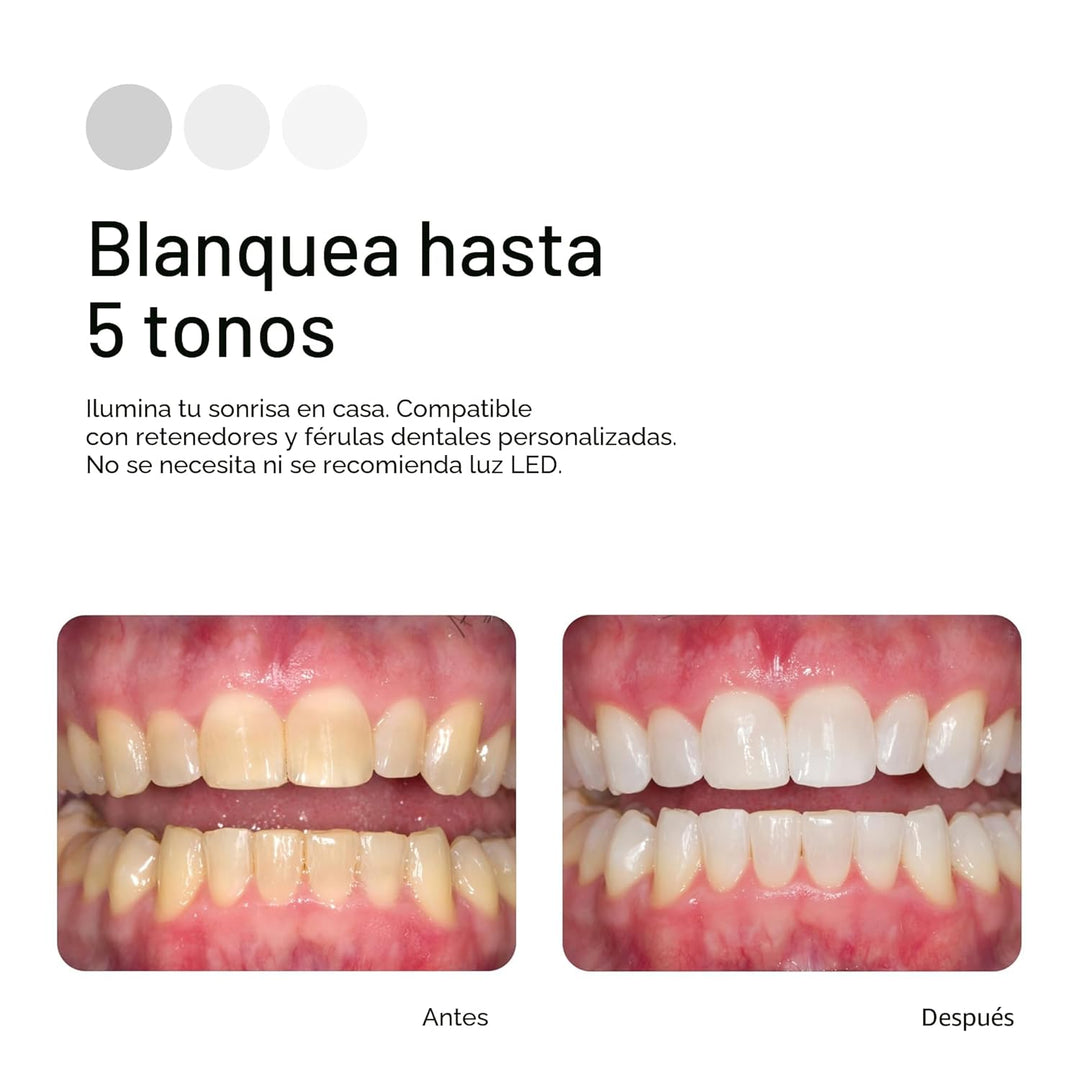 Opalescence 35% CP Mint - Jeringas de gel para blanquear los diente...