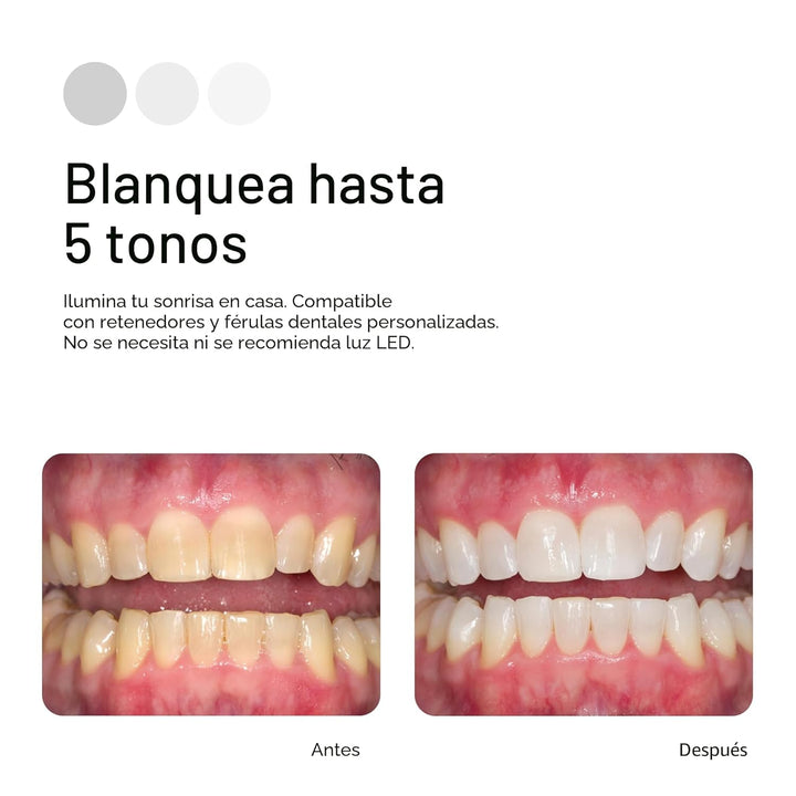Opalescence 35% CP Mint - Jeringas de gel para blanquear los diente...