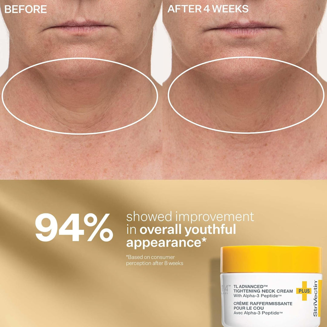 StriVectin Tighten & Lift Peptight Face Lift Serum con péptidos ten...