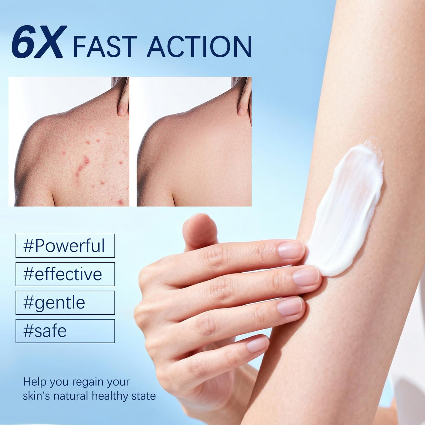 OUHENGTEK Crema de foliculitis | Alivia y ayuda a eliminar protuber...