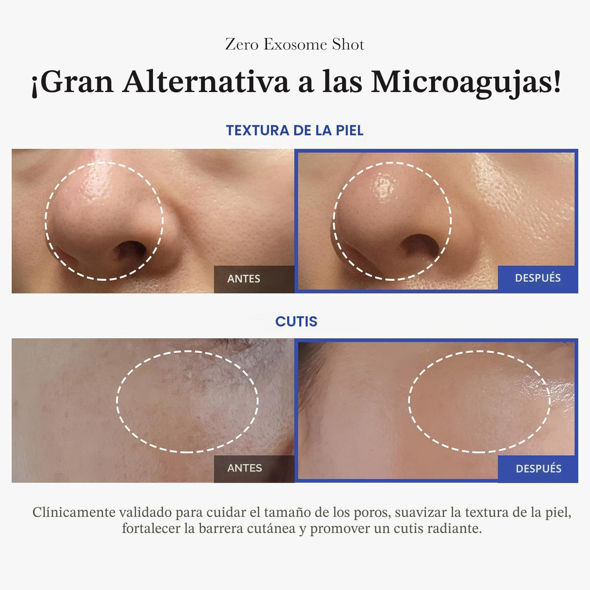 Medicube Zero Exosome Shot 2,000 PPM Espícula Suero Facial | Suero...