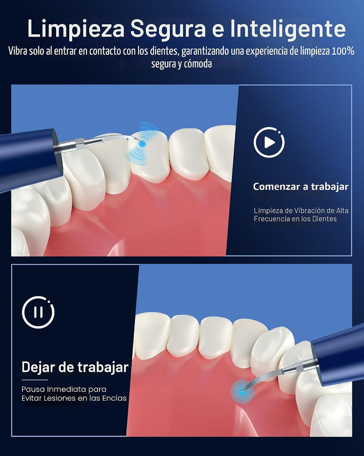Removedor de placa para dientes, removedor de sarro para dientes co...