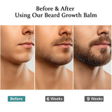 Estimulante para Barba \u2013 Bálsamo de Crecimiento Ultra Potente,...