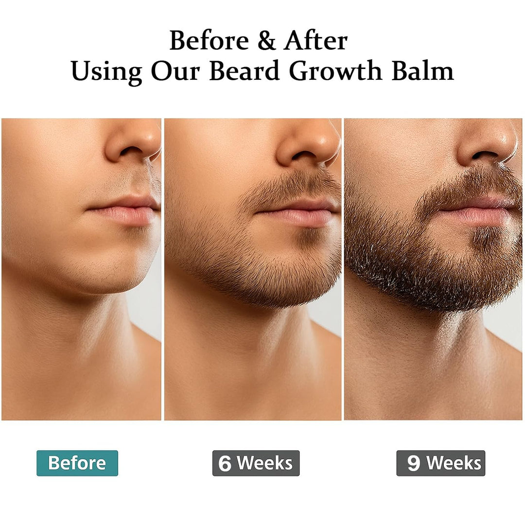 Estímulo para Barba \u2013 Bálsamo de Crecimiento Ultra Potente, Bá...