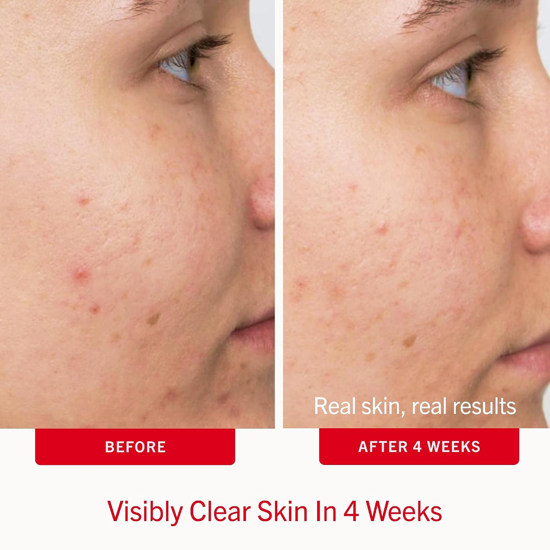 Almohadillas de tratamiento facial diario de belleza de primeros au...