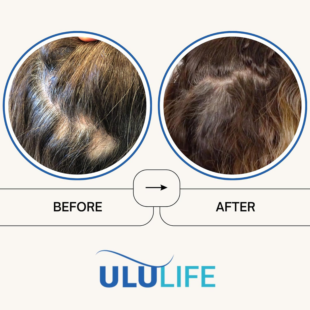 ULULIFE Multivitamínico Ultimate Regrow: promueve el crecimiento de...