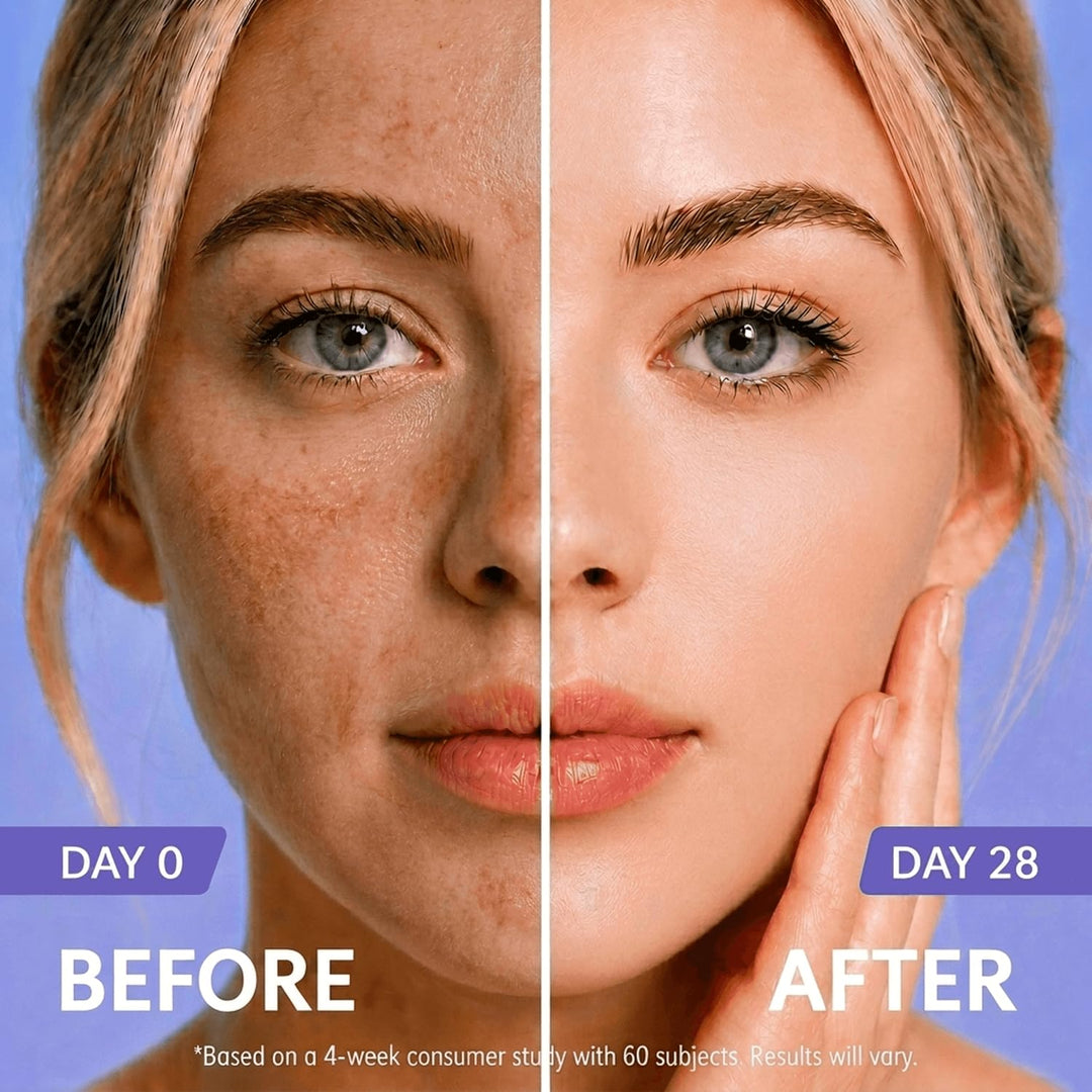 Removedor de manchas oscuras para cara y cuerpo con 20,000 ppm de n...
