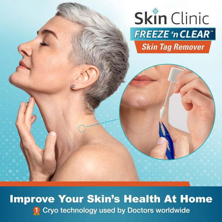 Skin Clinic Freeze n Clear Removedor de marcas cutáneas