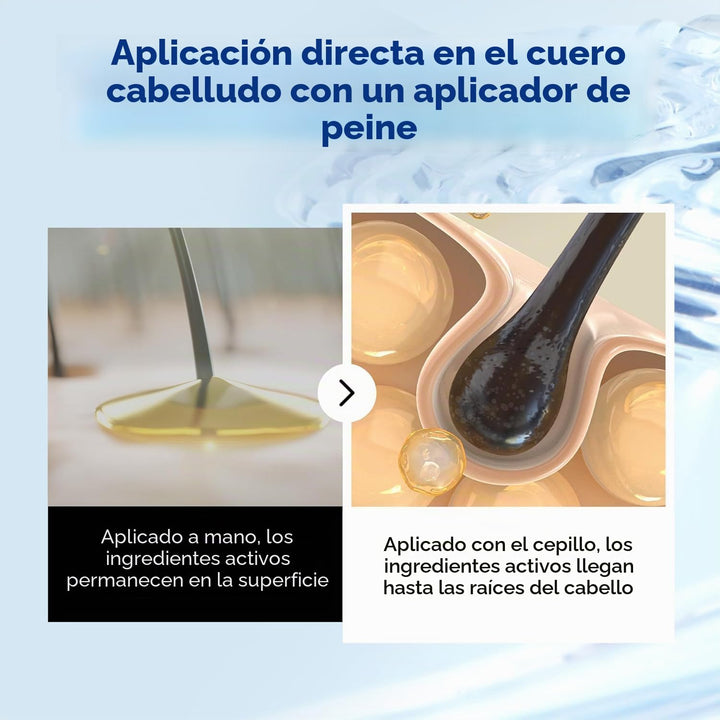 EPAIS Suero potenciador del cuero cabelludo (cuidado completo del c...