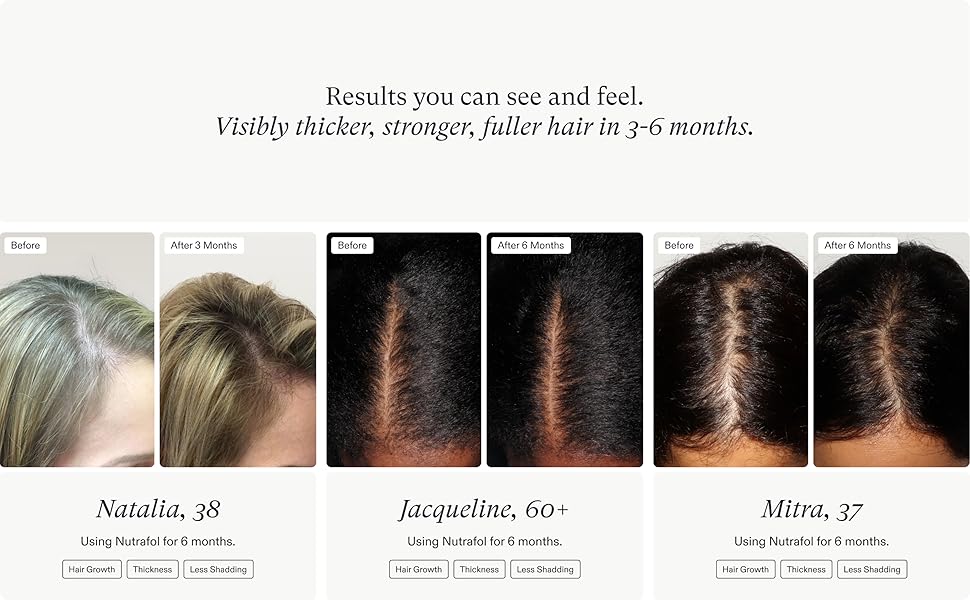 Nutrafol Suplemento para cabello delgado avanzado para