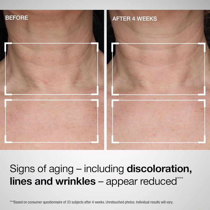 StriVectin Tighten and Lift Advanced Neck Cream PLUS with Alpha-3 P...