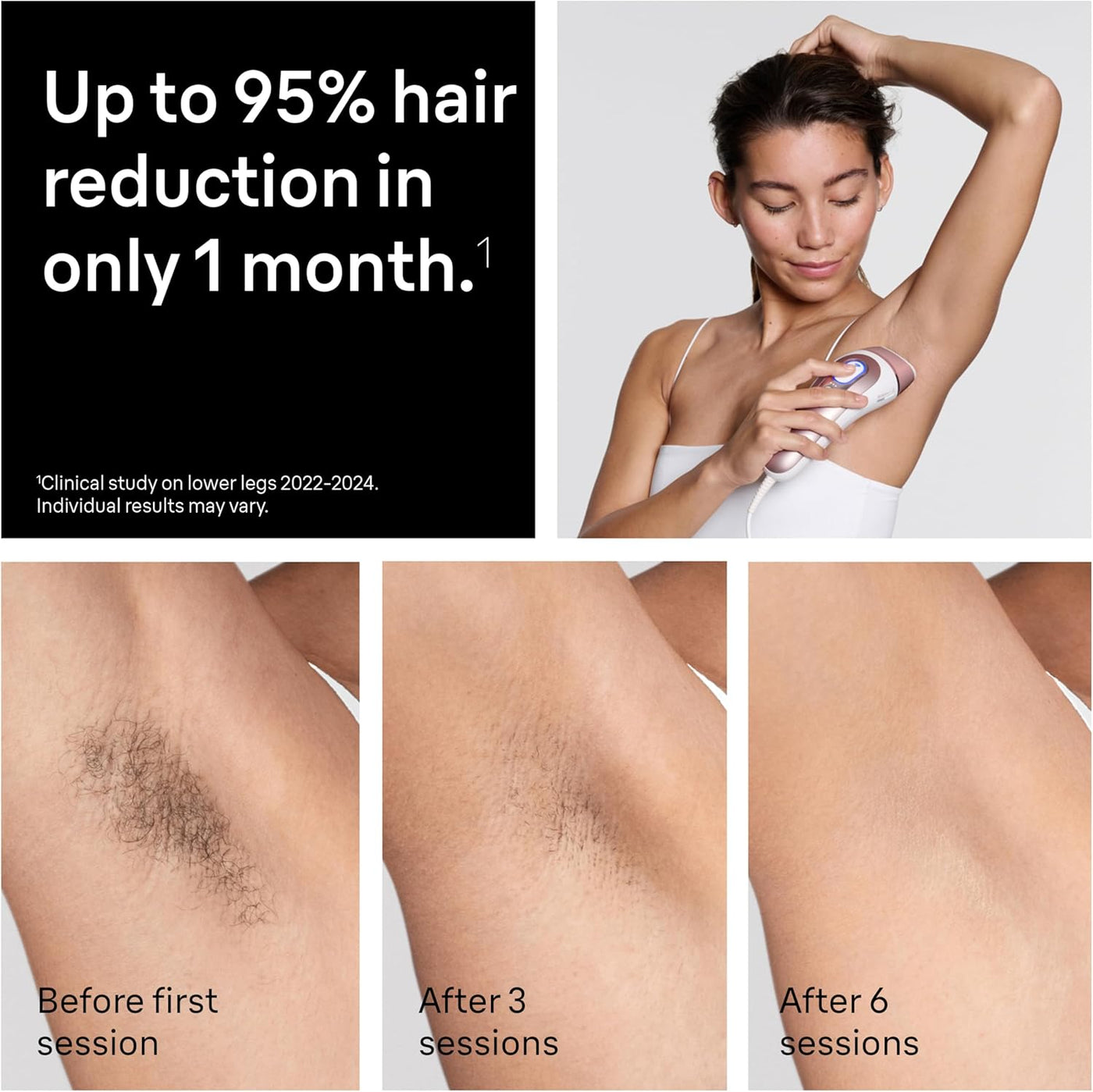 Braun Skin i-Expert Smart IPL PL7219 - Depilación láser para mujere...