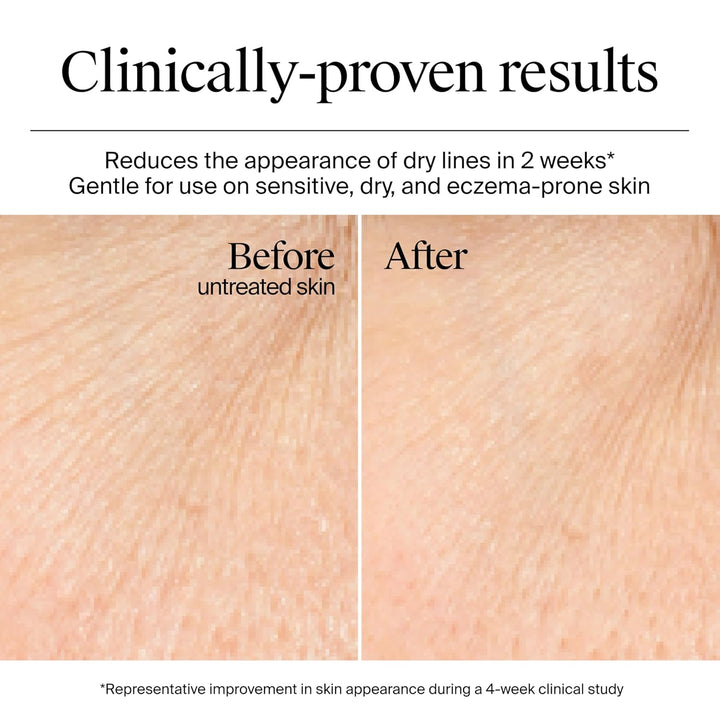 Neutrogena Hydro Boost Gel Cream sin fragancia, hidratante facial d...