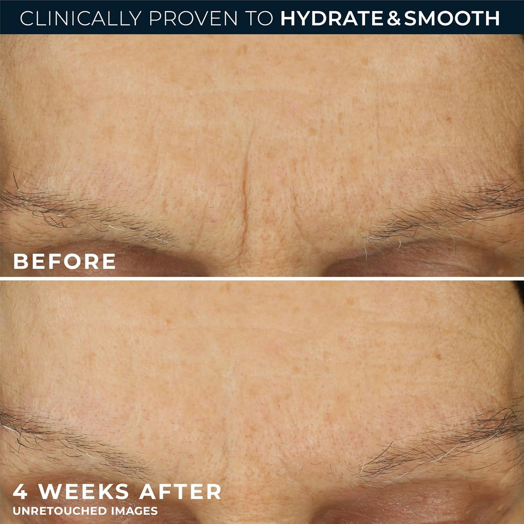 RoC Retinol Correxion Max Hydration - Hidratante facial diario anti...