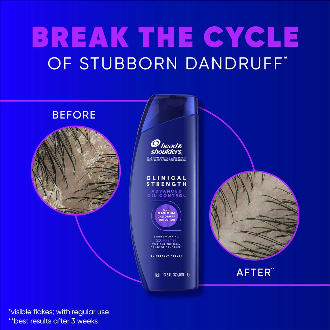Head &amp; Shoulders Champú anticaspa, paquete doble de control de...