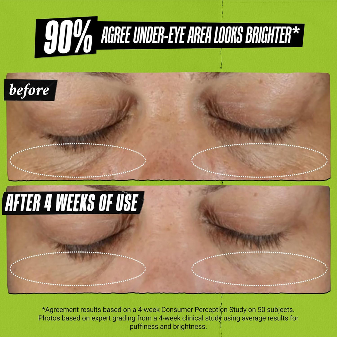Kiehl's Tratamiento de ojos de aguacate, crema debajo de los oj...