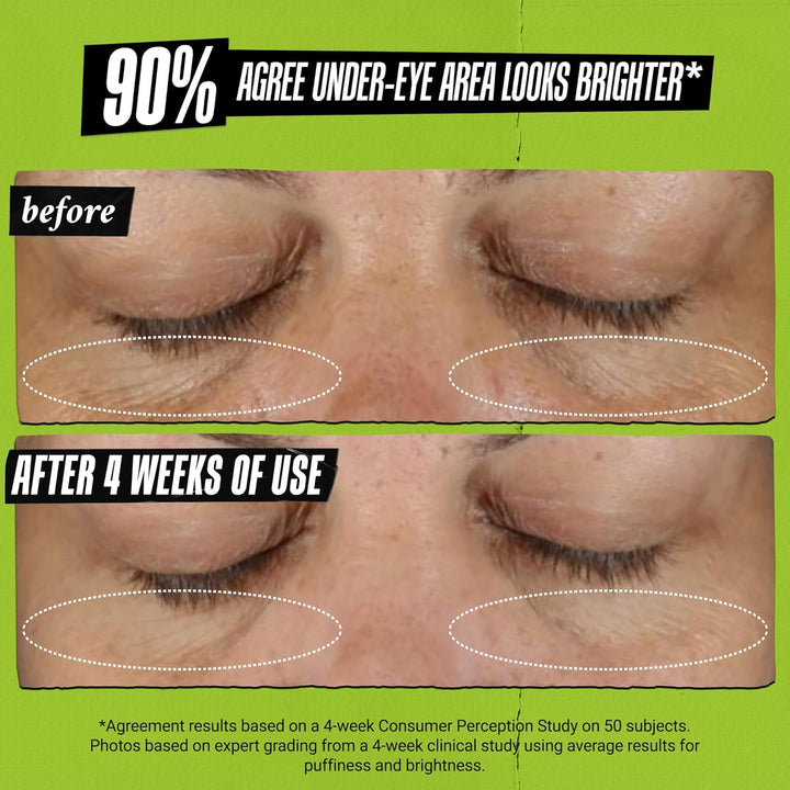 Kiehl's Tratamiento de ojos de aguacate, crema debajo de los oj...