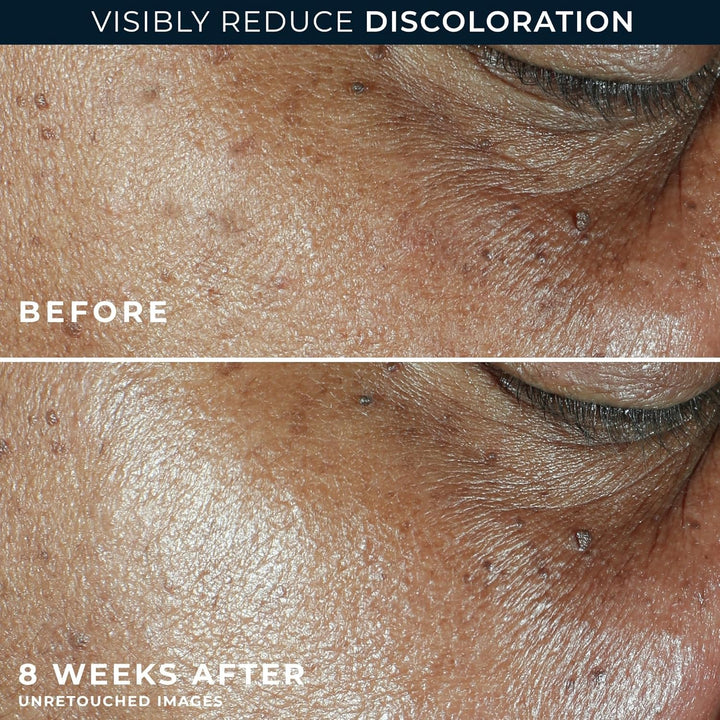 RoC Multi Correxion 5 en 1 hidratante facial diario antienvejecimie...