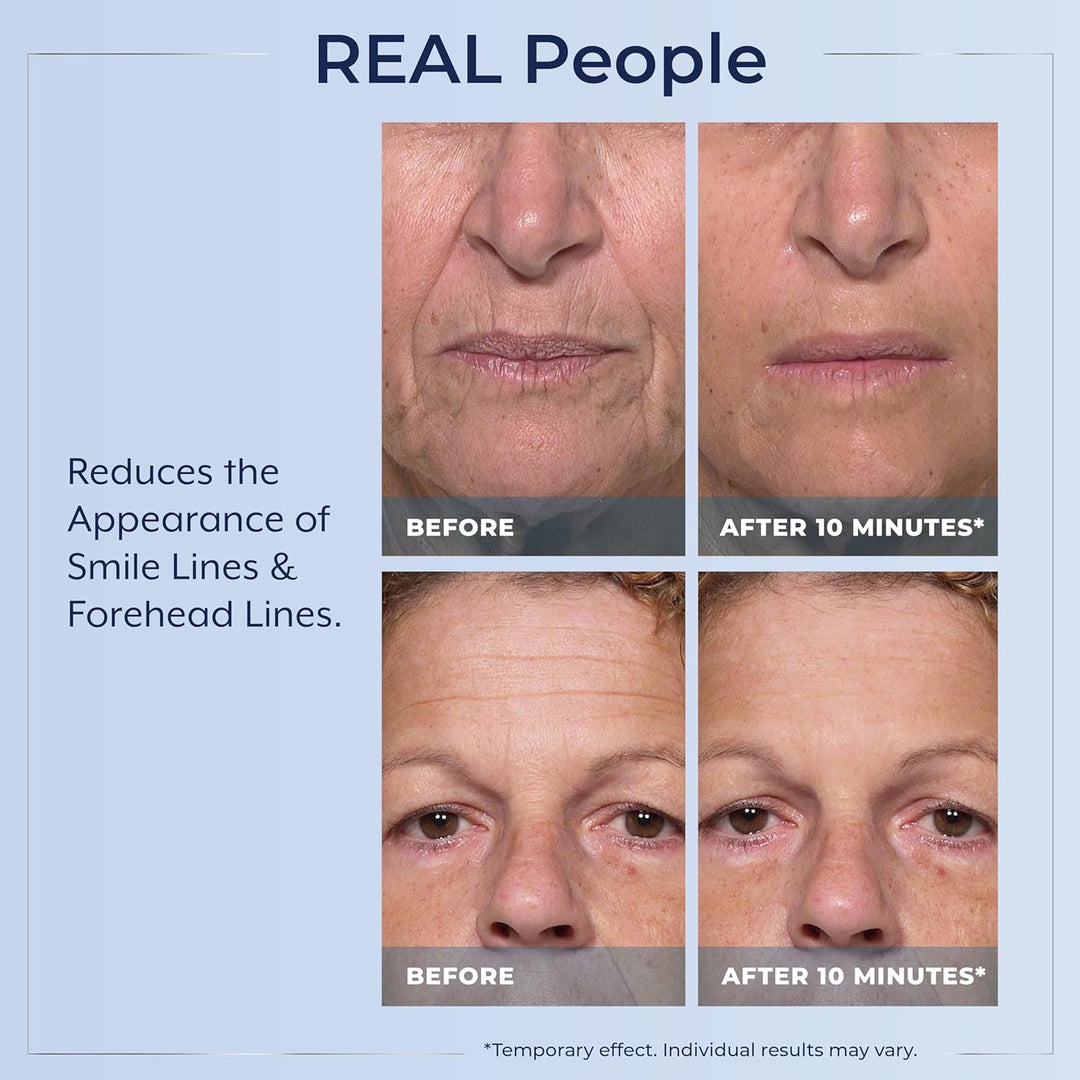 Plexaderm Suero de ojos de reducción rápida: reduce visiblemente la...