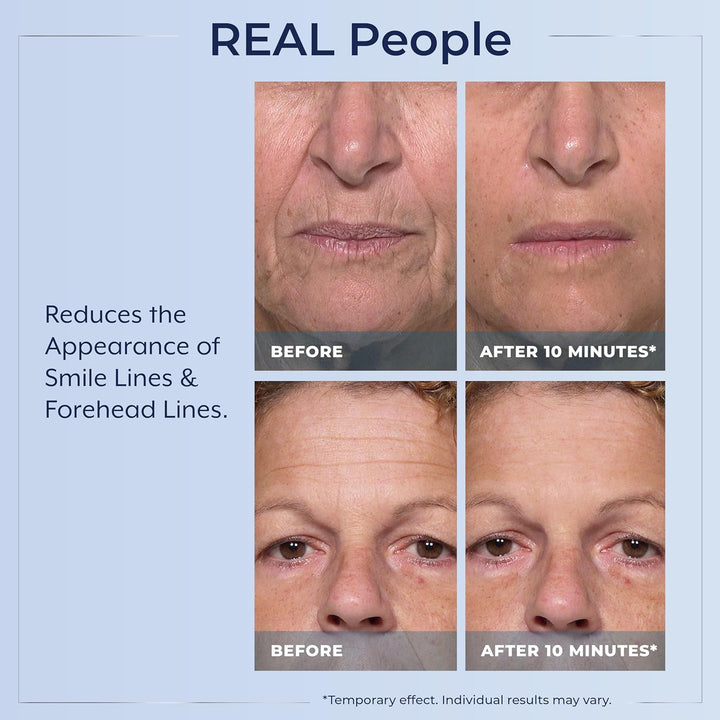 Plexaderm Suero de ojos de reducción rápida: reduce visiblemente la...