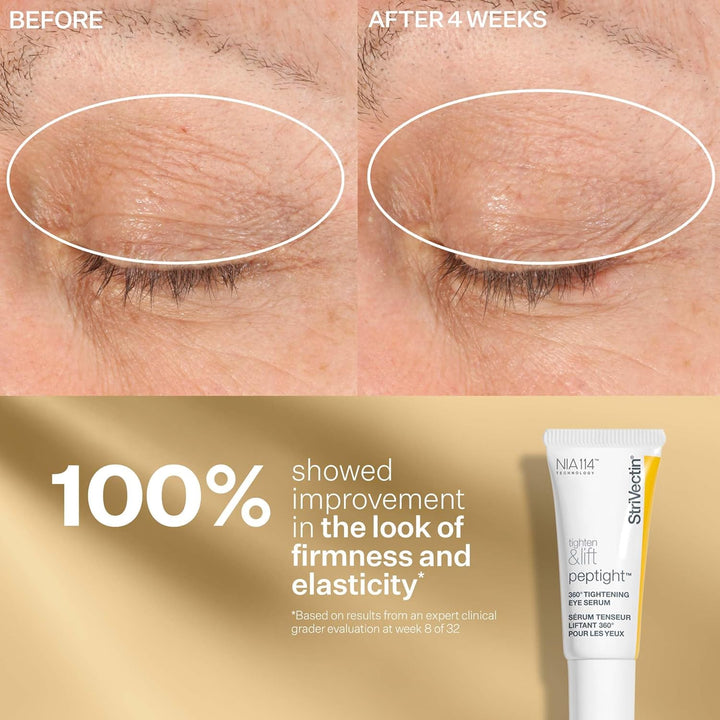 StriVectin Tighten & Lift Peptight Face Lift Serum con péptidos ten...