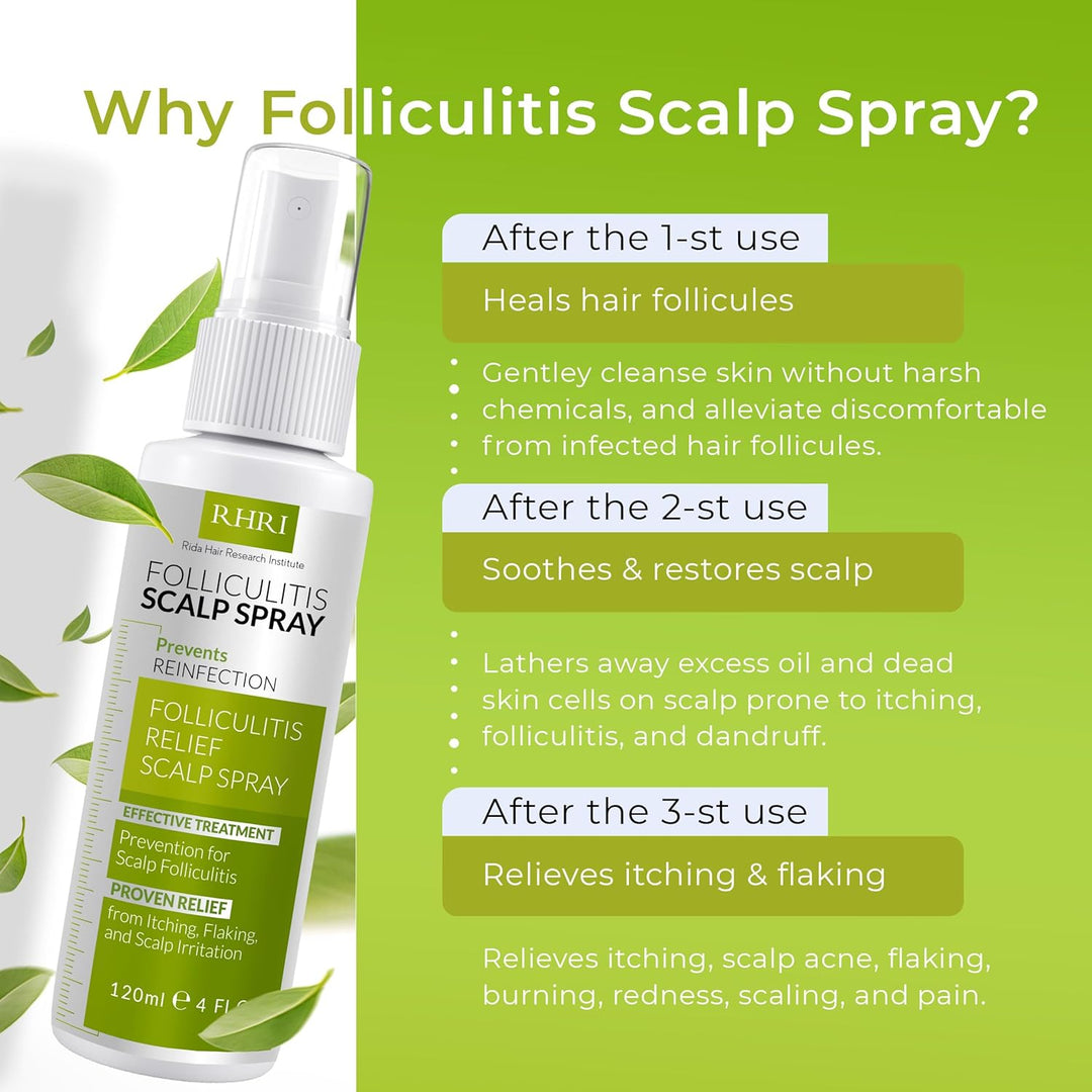 Spray para el cuero cabelludo para foliculitis | Tratamiento de la...