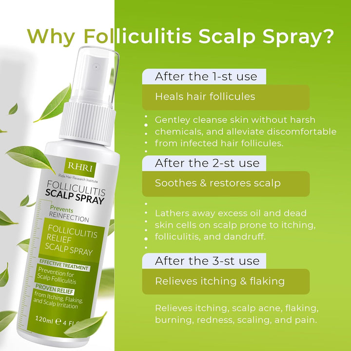 Spray para el cuero cabelludo para foliculitis | Tratamiento de la...