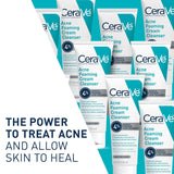CeraVe Limpiador en crema espumosa para el acné lavado