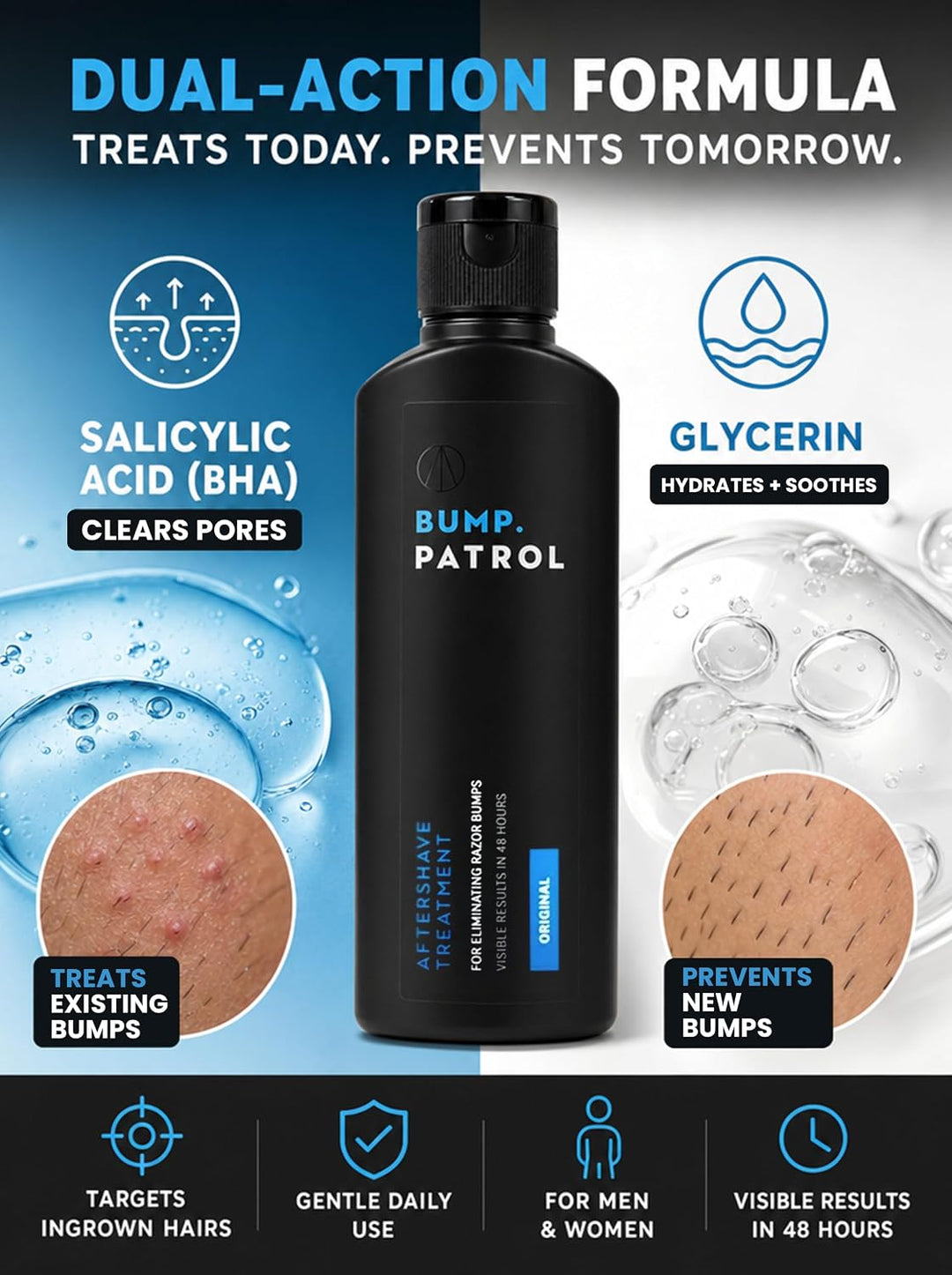 Bump Patrol Original Formula - Sérum para tratamiento de golpes des...