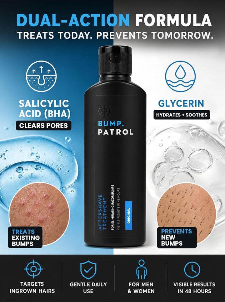 Bump Patrol Original Formula - Sérum para tratamiento de golpes des...