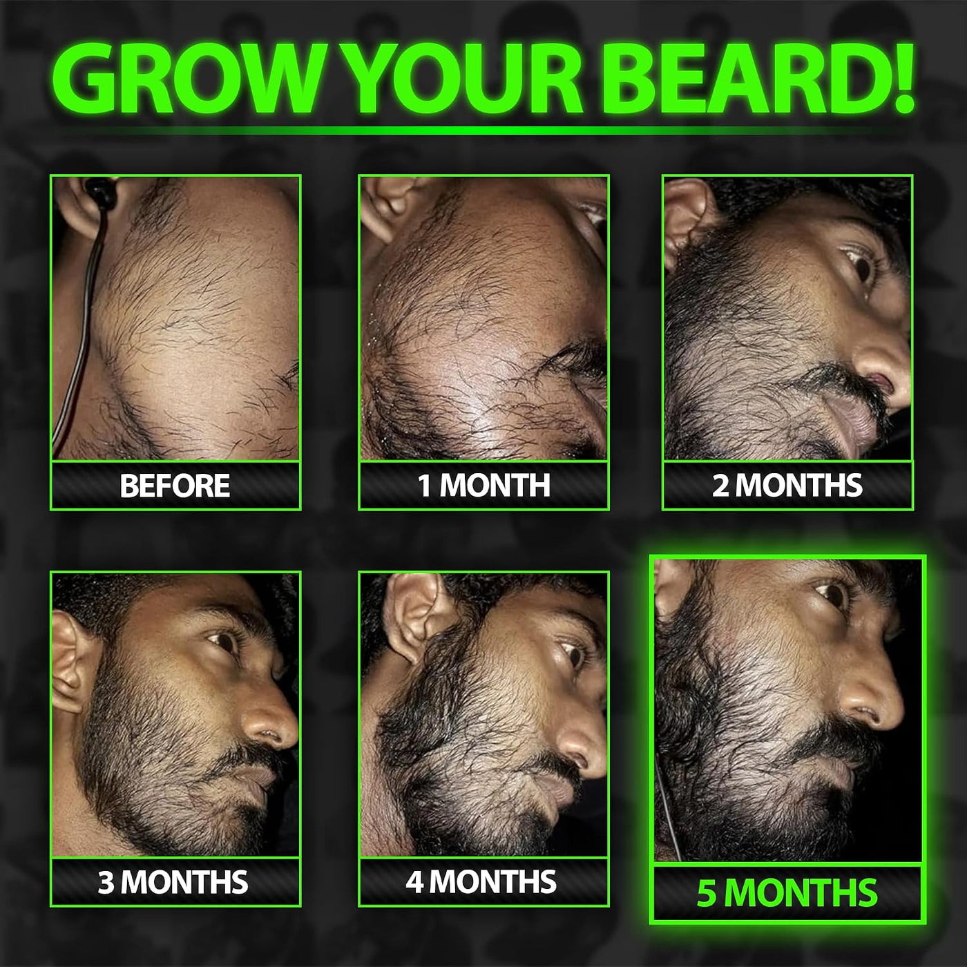 Suero para el Crecimiento de la Barba - GROW Maximum XXL Aceite par...