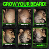 Suero para el Crecimiento de la Barba - GROW Maximum XXL Aceite par...