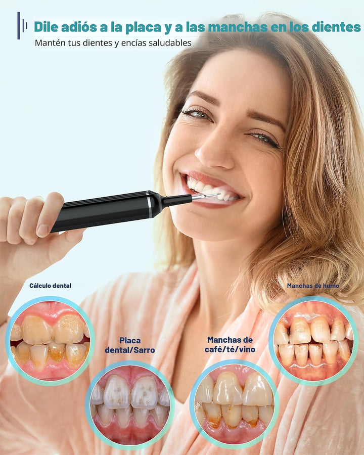Removedor de placa para dientes, kit de limpieza dental removedor d...