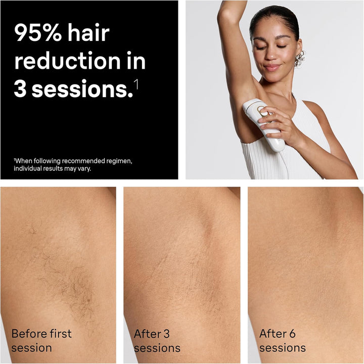 Braun IPL Silk·Expert Pro 5 PL5347 - Sistema de depilación en casa...