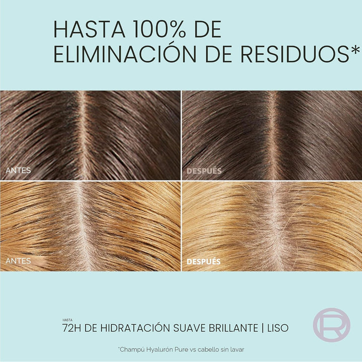 L'Oreal Paris Elvive Hyaluron + Pure - Juego de champú y acondi...
