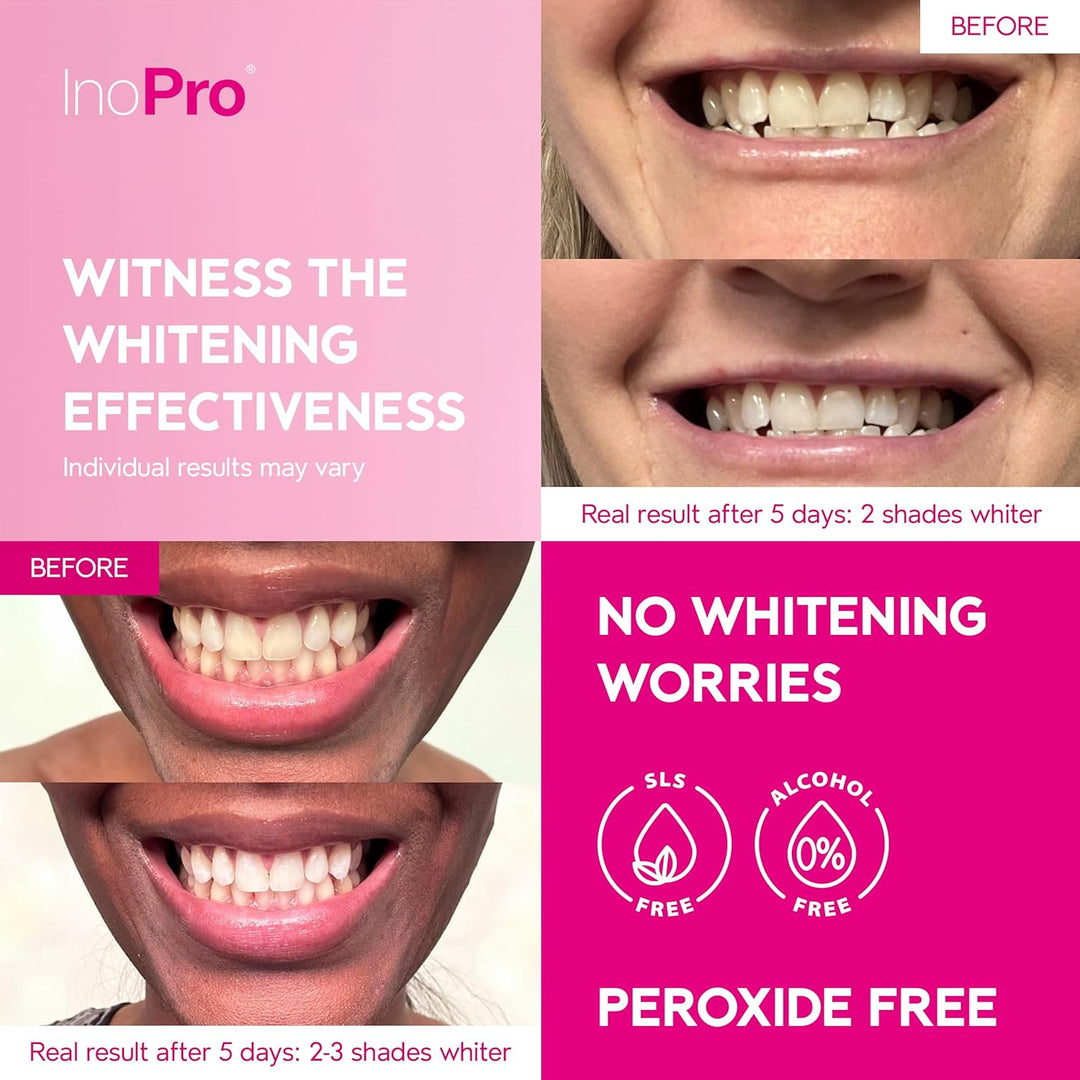 InoPro Kit de 14 Tratamientos de Tiras Blanqueadoras Dentales - Bla...