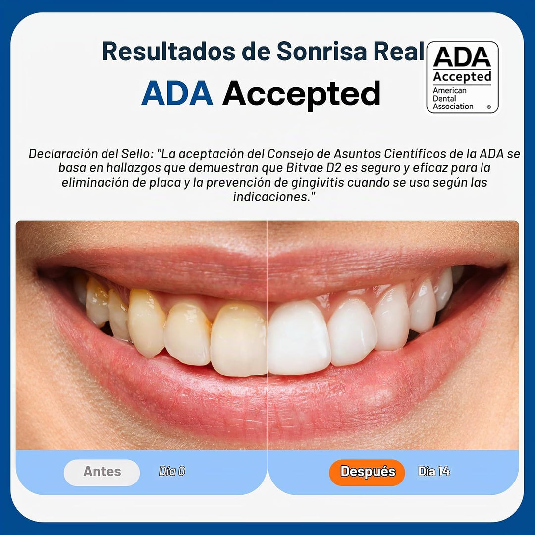 Cepillo de dientes eléctrico aceptado por la ADA Bitvae, cepillo de...