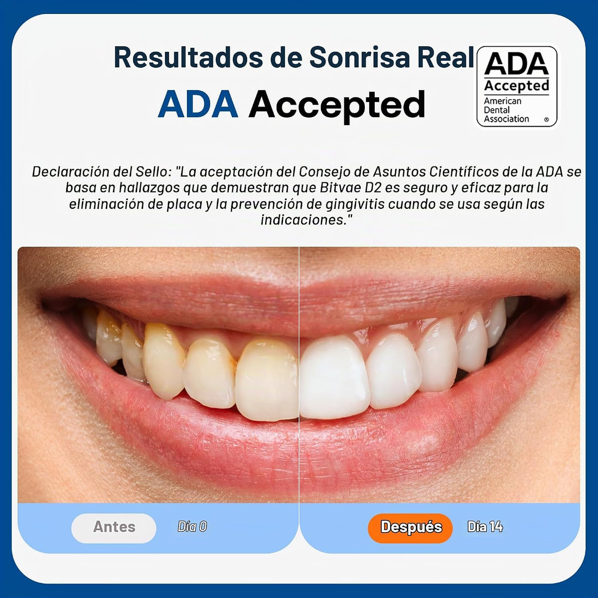 Cepillo de dientes eléctrico aceptado por la ADA Bitvae, cepillo de...