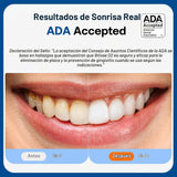 Cepillo de dientes eléctrico aceptado por la ADA Bitvae, cepillo de...