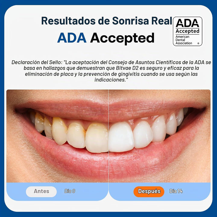 Cepillo de dientes eléctrico aceptado por la ADA Bitvae, cepillo de...