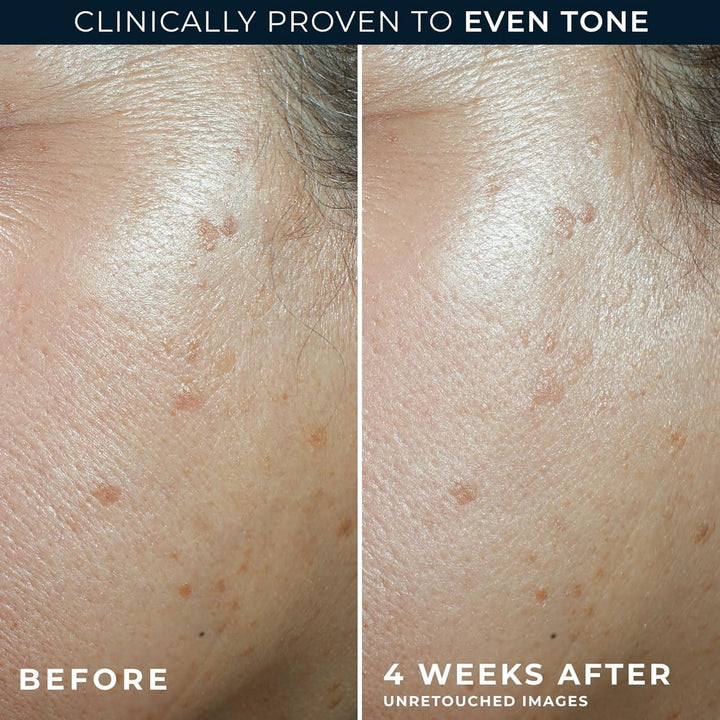 RoC Multi Correxion 5 en 1 hidratante facial diario antienvejecimie...