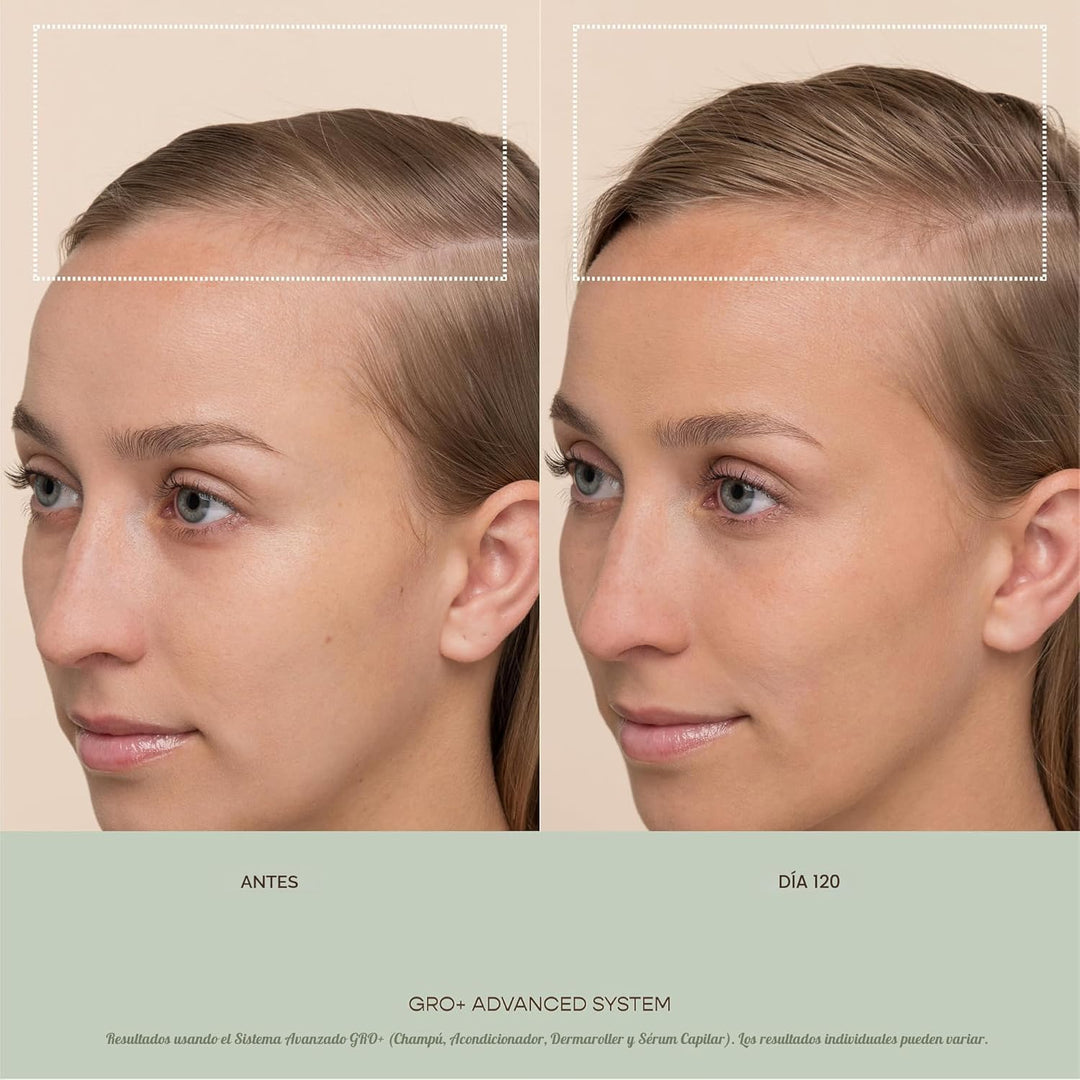 VEGAMOUR GRO+ Advanced Dermaroller | 1,200 Microneedles de 0.25mm H...